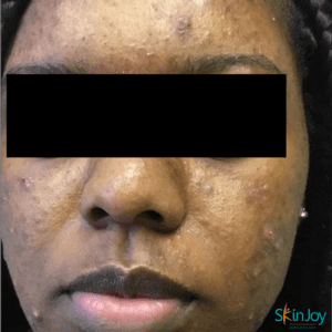 Dermatogy