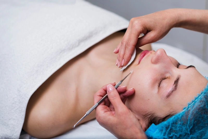 What Are Benign Skin Growths and How Can They Be Treated?