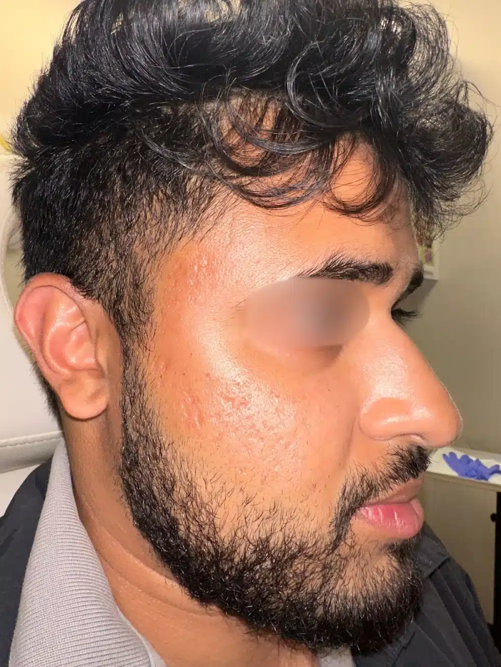 Patient 1 Before (1)