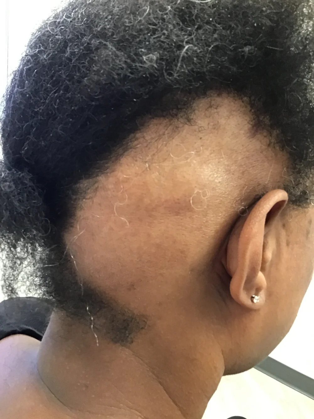 Patient 2 before (2)