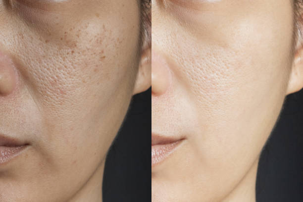 7 Skin Conditions That Require a Dermatologist for Skin of Color