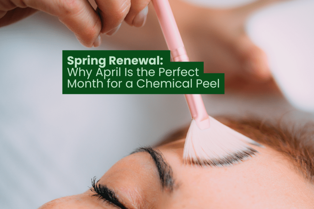 Spring Renewal: Why April Is the Perfect Month for a Chemical Peel