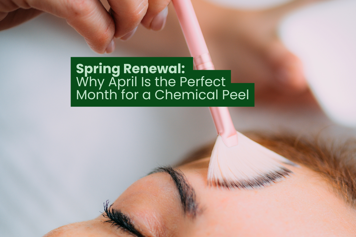 Spring Renewal: Why April Is the Perfect Month for a Chemical Peel