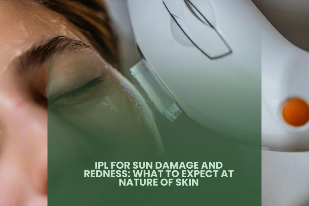 IPL for Sun Damage and Redness: What to Expect at Nature of Skin