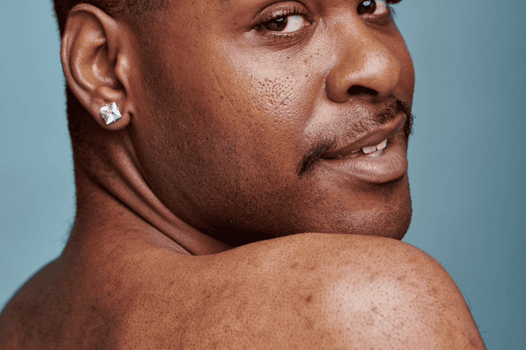 Hyperpigmentation and Sun Exposure: What Patients with Skin of Color Need to Know