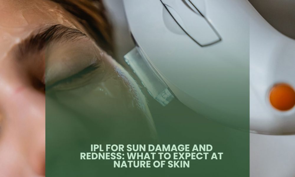 IPL for Sun Damage and Redness: What to Expect at Nature of Skin