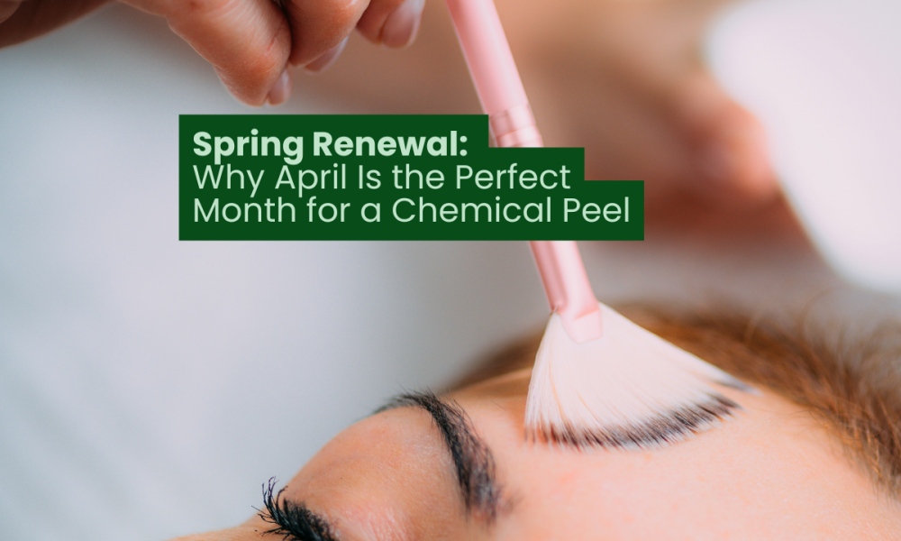 Spring Renewal: Why April Is the Perfect Month for a Chemical Peel