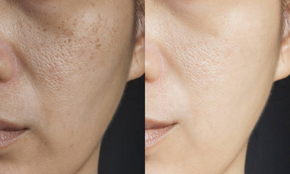 Dermatologist for Skin of Color